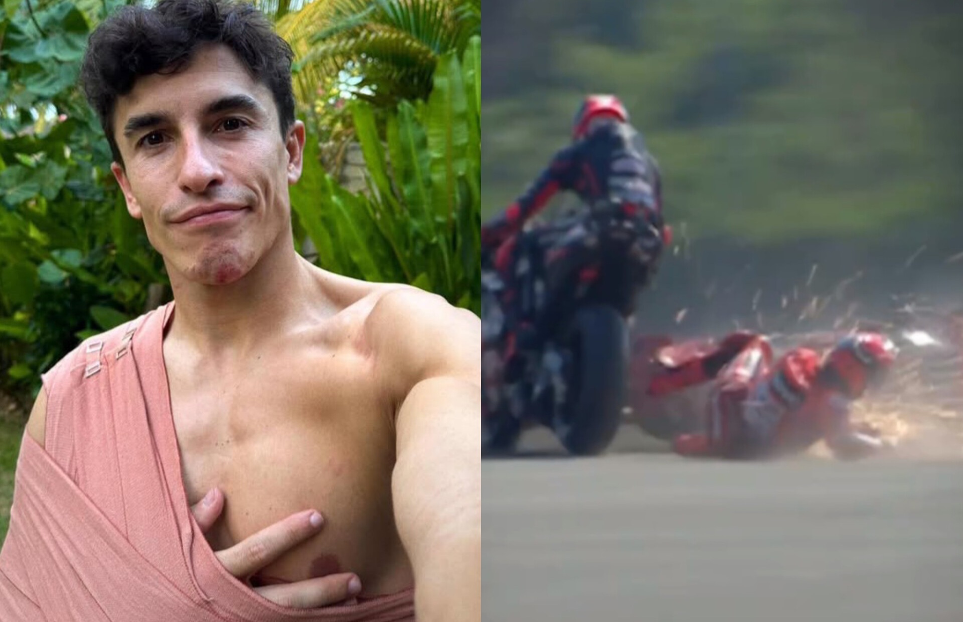 Marquez Jatuh Patah Tulang Bahu di MotoGP Mandalika, Kutukan Berlanjut!